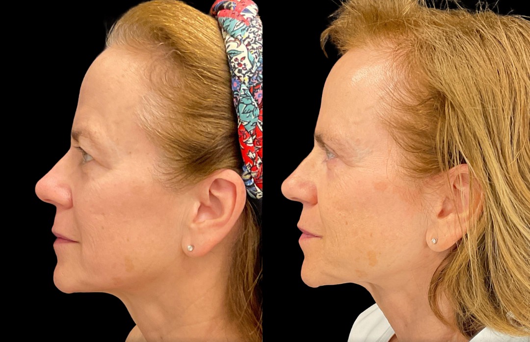 Copy of Untitled Design – 5