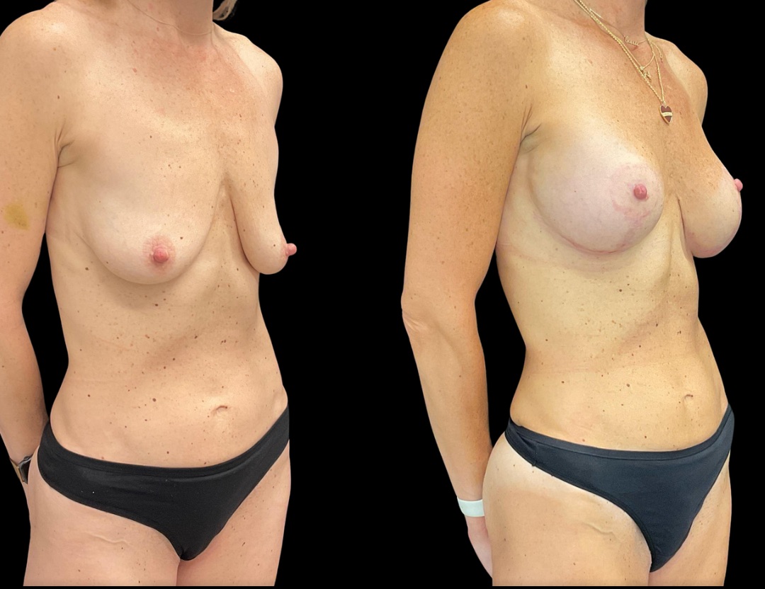 Copy of Untitled Design