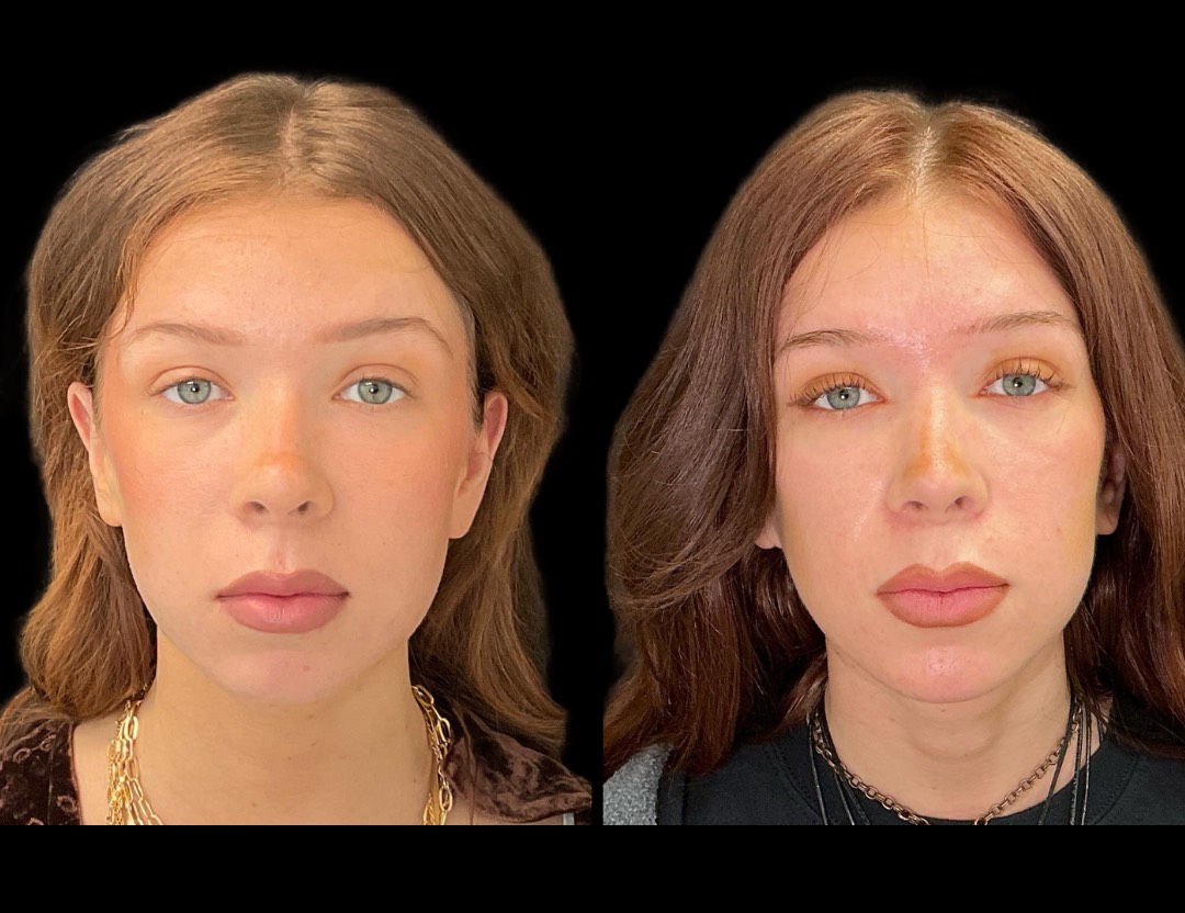 Copy of 5818 Blenheim female before and after – 1