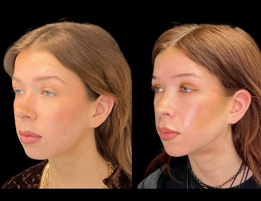 Copy of 5818 Blenheim female before and after – 2