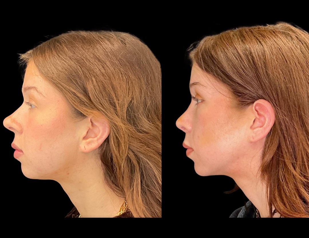 Copy of 5818 Blenheim female before and after – 3