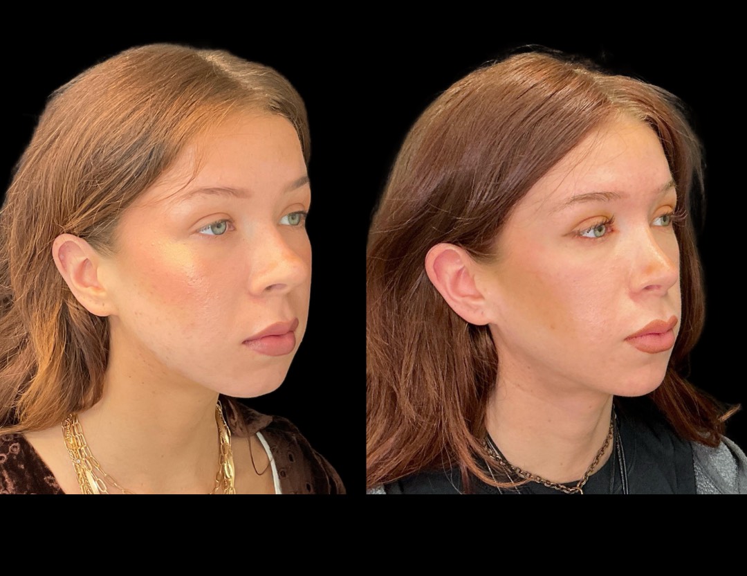 Copy of 5818 Blenheim female before and after – 4