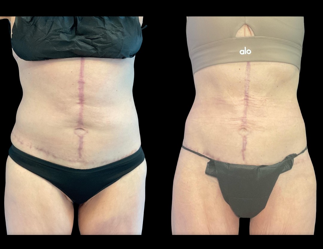 Copy of Copy of Untitled Design – 1