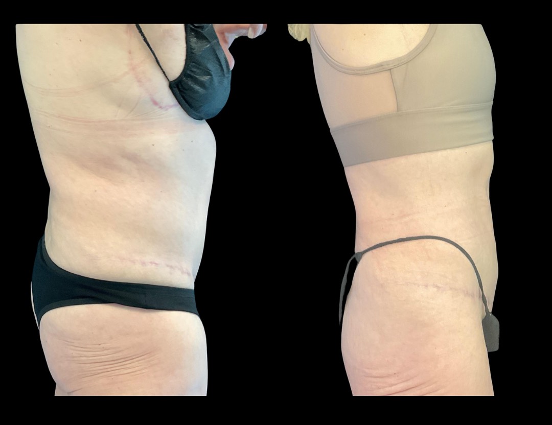 Copy of Copy of Untitled Design – 2