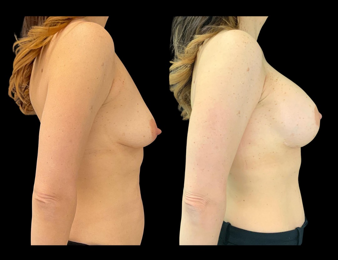 Copy of Untitled Design – 2